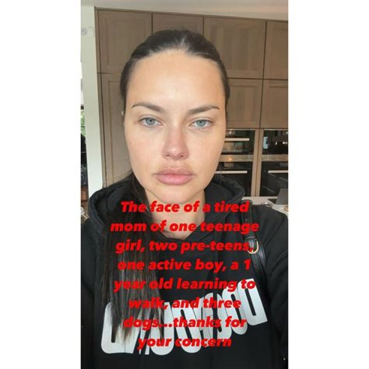 Adriana Lima: Embracing Beauty Beyond the Scale