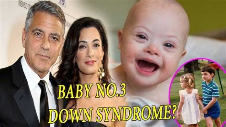 Does George Clooney's Son Have Down's Syndrome? Understanding the Rumors and Facts