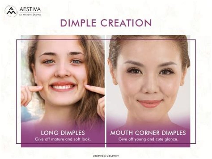 Exploring the Fascinating World of Dimples: Types and More