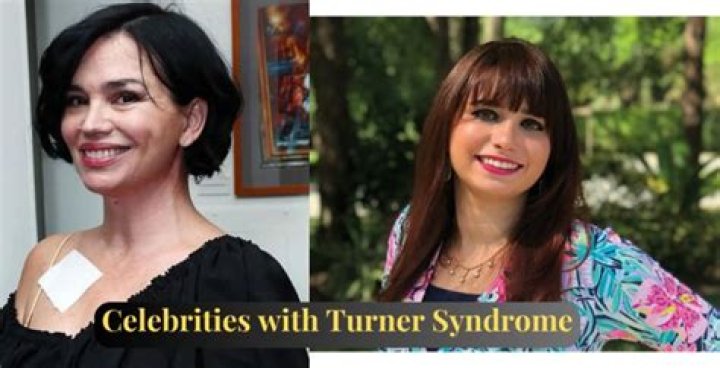 Inspiring Female Celebrities with Turner Syndrome