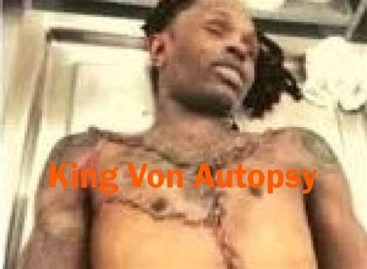 King Von Autopsy Report: Unveiling the Truth Behind His Untimely Death