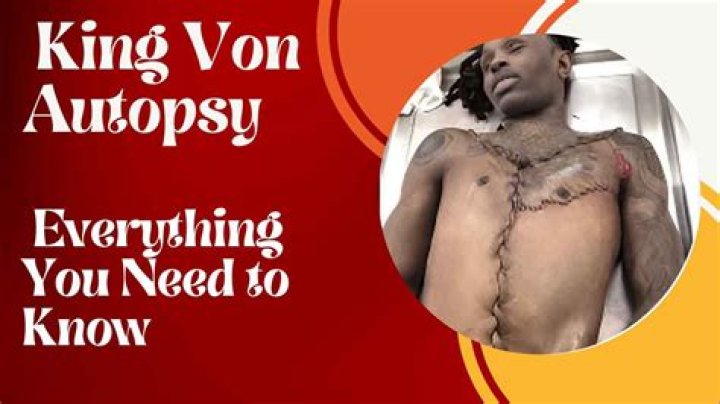 King Von Death Autopsy: Uncovering the Truth Behind His Untimely Demise
