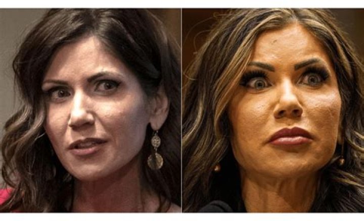 Kristi Noem Face Surgery: A Comprehensive Look at the Transformation