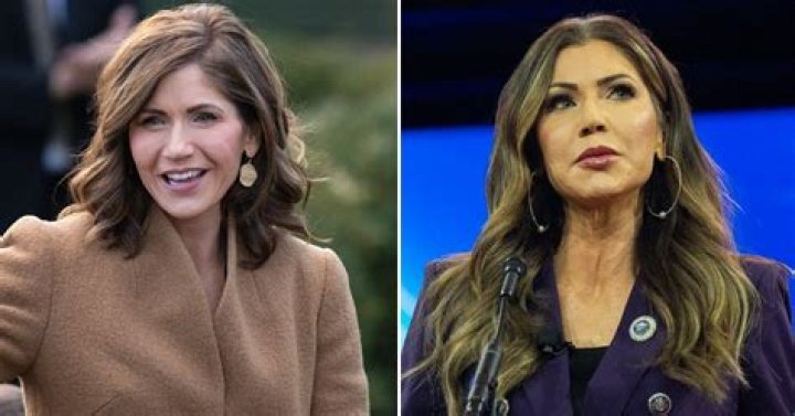 Kristi Noem Fillers: Exploring the Truth Behind the Rumors