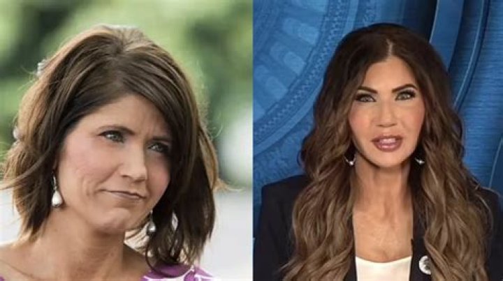 Kristi Noem Plastic Surgery: Unveiling the Truth Behind the Transformation