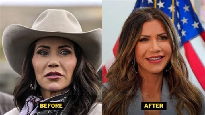 Kristy Noem Plastic Surgery: Everything You Need to Know