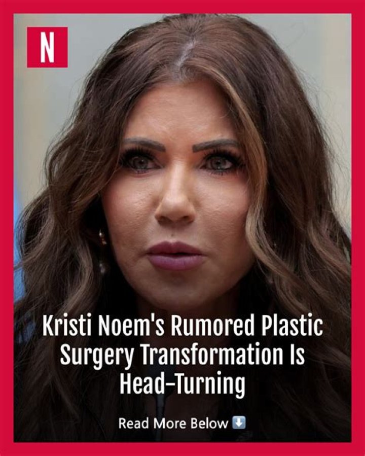 Noem Plastic Surgery: A Comprehensive Guide to Cosmetic Procedures