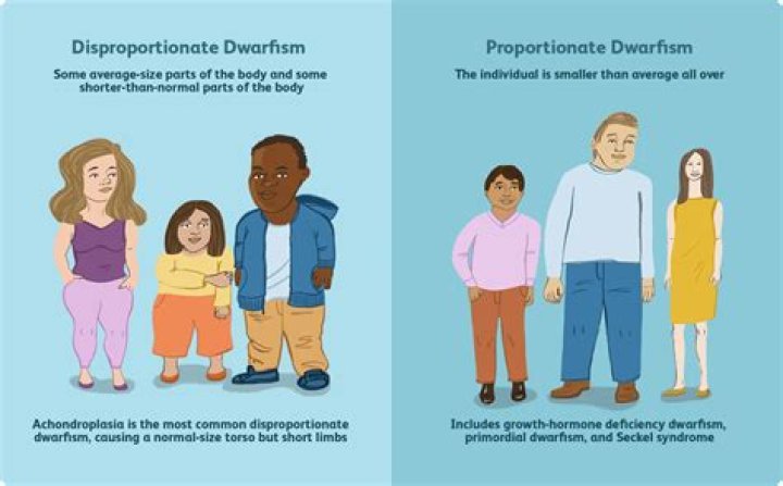 Peter Dinklage's Son: Understanding Dwarfism and Its Impact